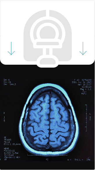 Is Your Brain Faulty?